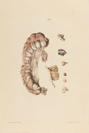  "Et stykke av tynntarmen" is a hand-colored lithograph on paper by Johan Ludvig Losting, featuring a realistic anatomical illustration of a section of the small intestine in muted pinks and browns, surrounded by smaller anatomical details, all against a warm cream background.