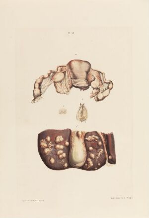  A hand-colored lithograph by an unknown artist, titled "Livmor med mortrompeter; en mortrompet; et stykke av leveren," depicting anatomical illustrations of a uterus with fallopian tubes, a single fallopian tube, and a section of liver, rendered in soft pinks, browns, and reddish tones on a pale background.