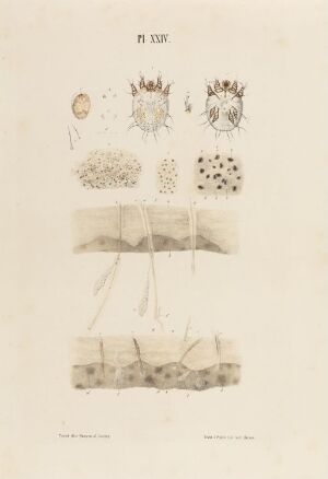  "Leprabasiller; utvikling av spedalskhet" - An antique scientific lithograph by an unknown artist depicting the leprosy bacteria development stages on paper, with hand-colored details in sepia, tan, brown, and gray tones, featuring circular microbial formations and tissue cross-sections.