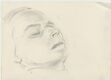 Study of a dying woman