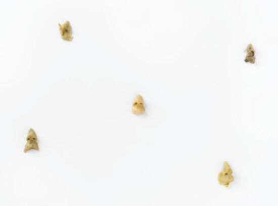 Pust kommer inn, pust går ut